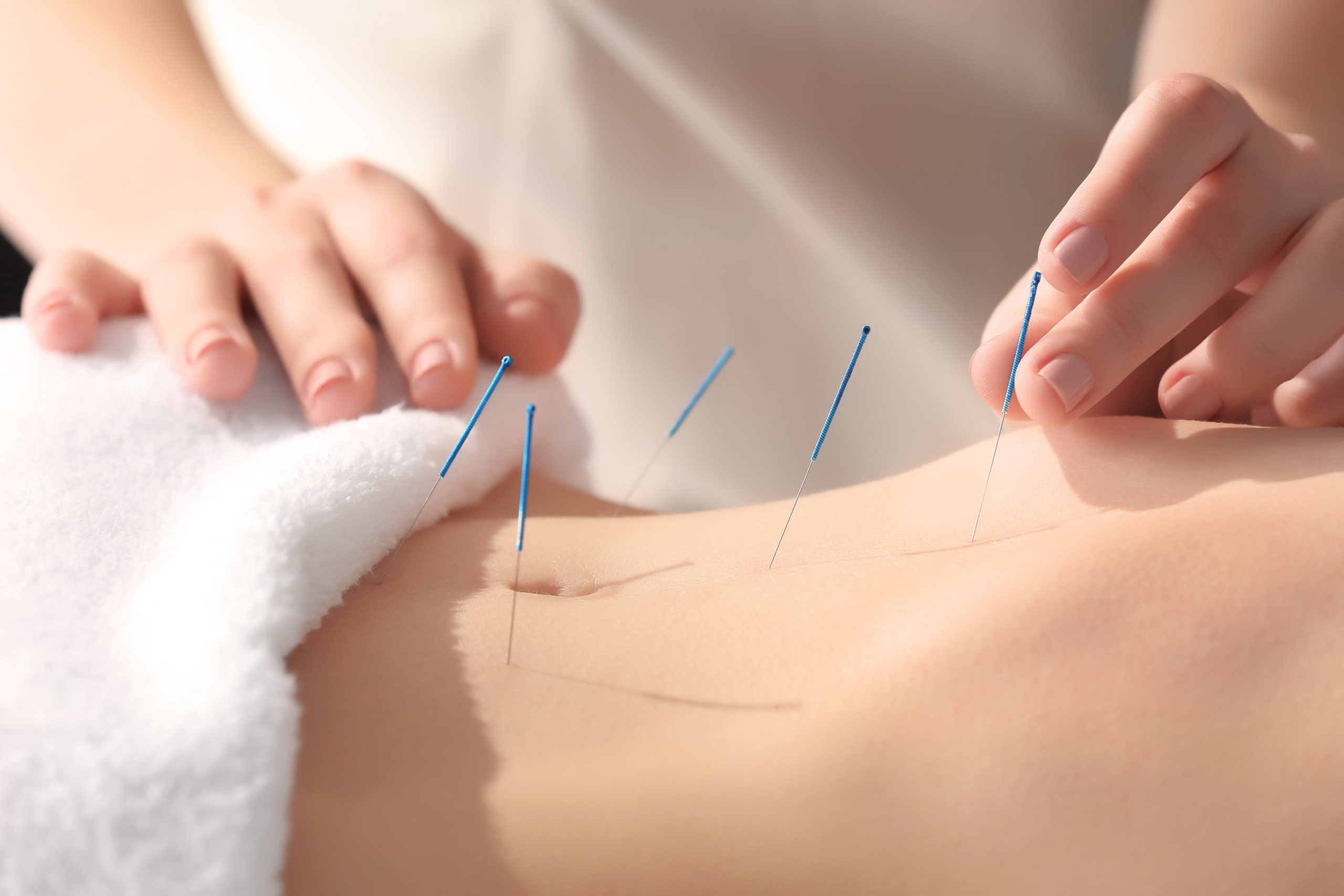The Role of Acupuncture in GI Health