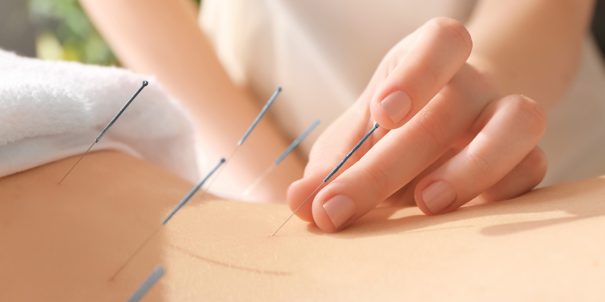 Acupuncture and Cancer Support