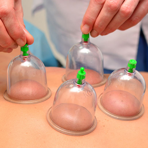 Cupping Corte Madera CA