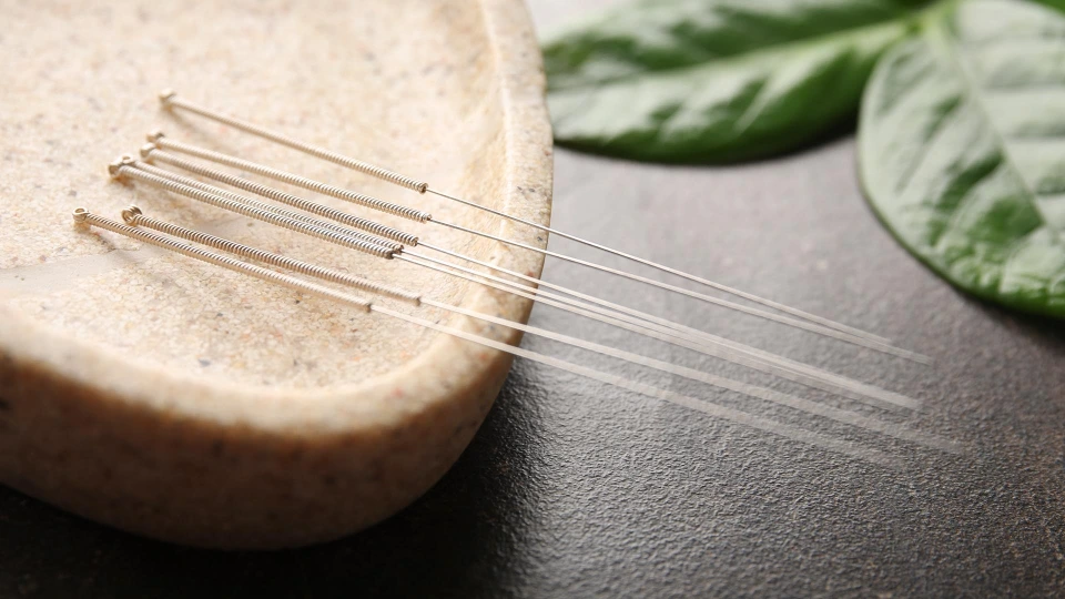 Acupuncture2.jpg